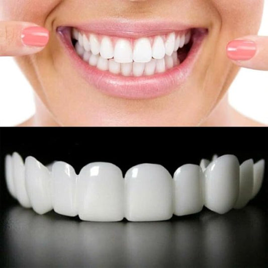 Snap on Smile Instant Confidence with a Brighter